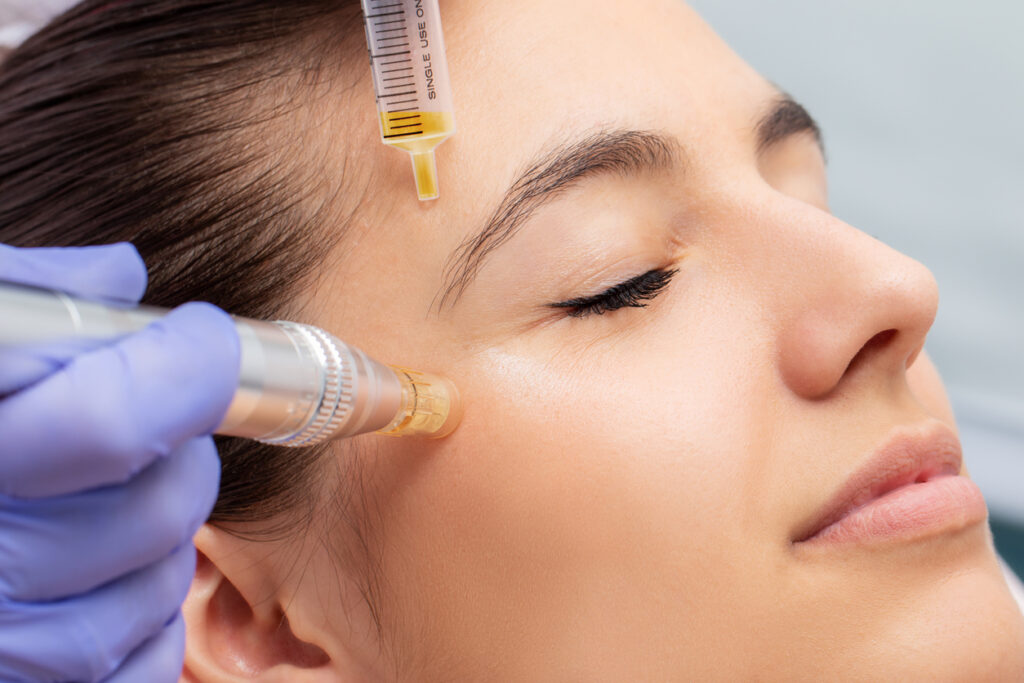 PLATELET RICH PLASMA