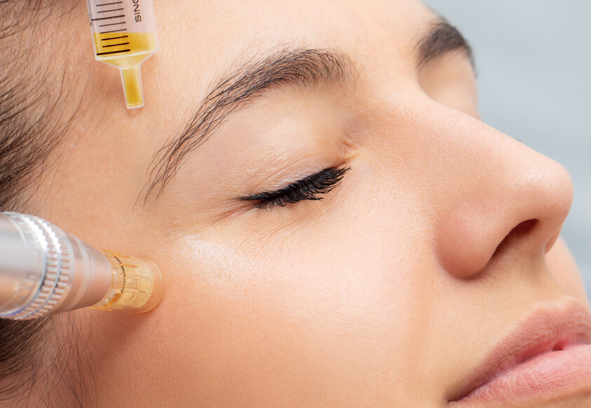 PLATELET RICH PLASMA