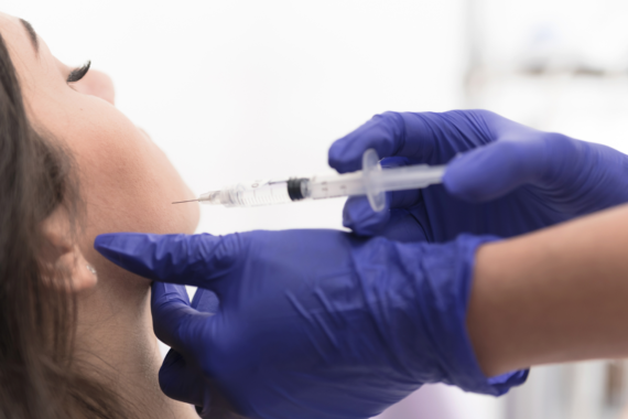 Masseter Botox